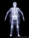x-ray.jpg